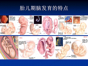 围产期因素与脑损伤PPT文档.ppt