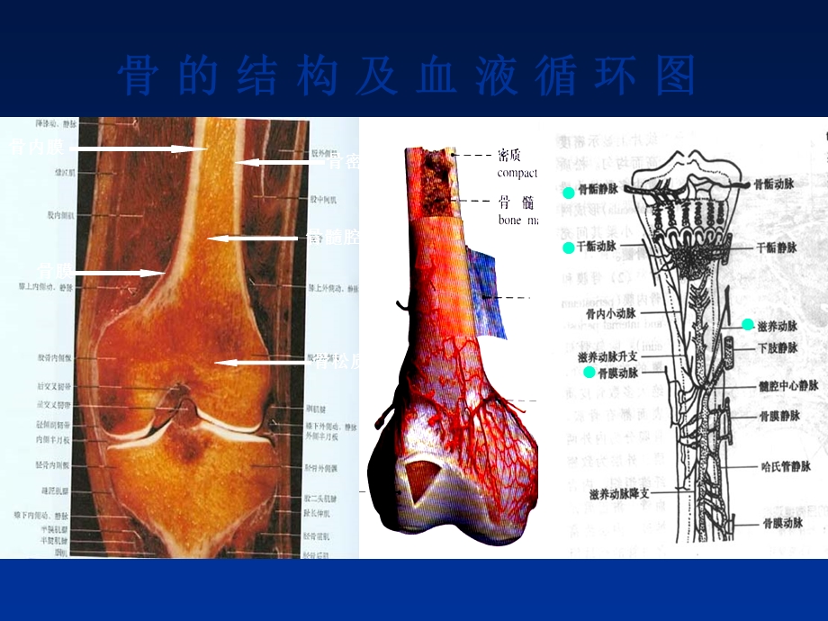 最新骨与关节基本病变X线表现PPT文档.ppt_第3页