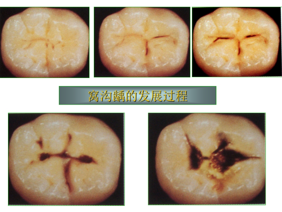 儿童口腔卫生保健文档资料.ppt_第1页