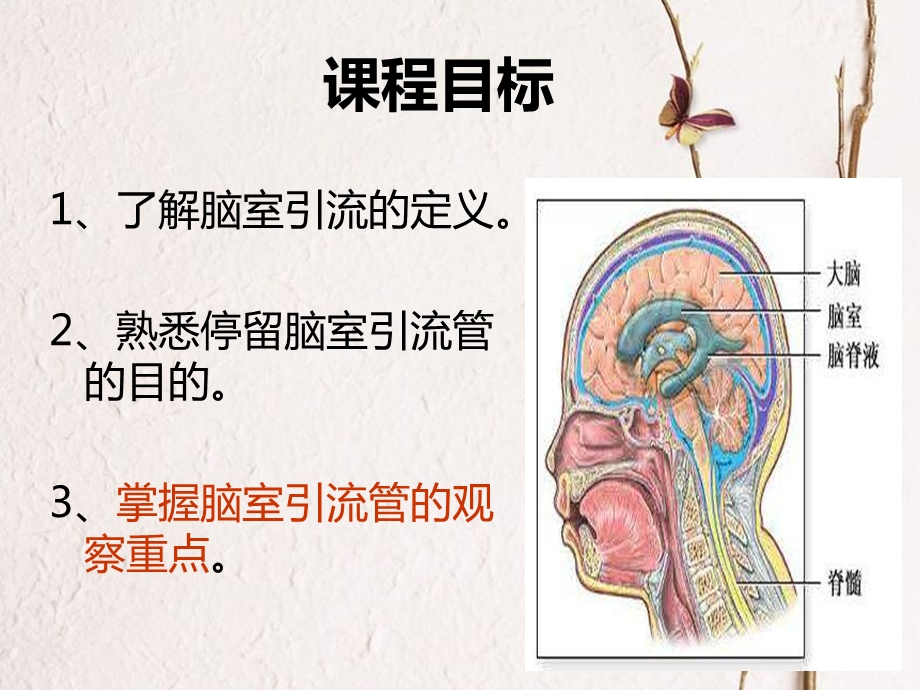 最新脑室引流管的观察重点PPT文档.ppt_第1页