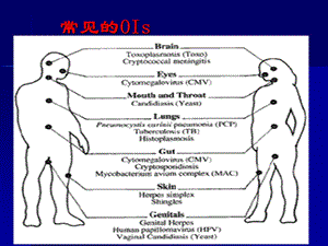 hiv机会感染治疗PPT文档.ppt