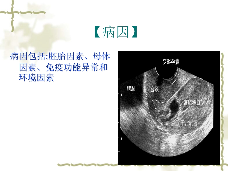 妊娠时限异常PPT文档资料.ppt_第1页