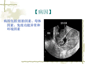 妊娠时限异常PPT文档资料.ppt