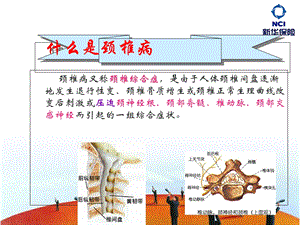 最新最新63日常保健之办公室工作人员如何预防颈椎病编制翟鑫鑫审核林超1PPT文档PPT文档.ppt