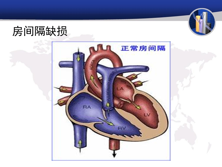 常见的心脏外科疾病简述精选文档.ppt_第3页