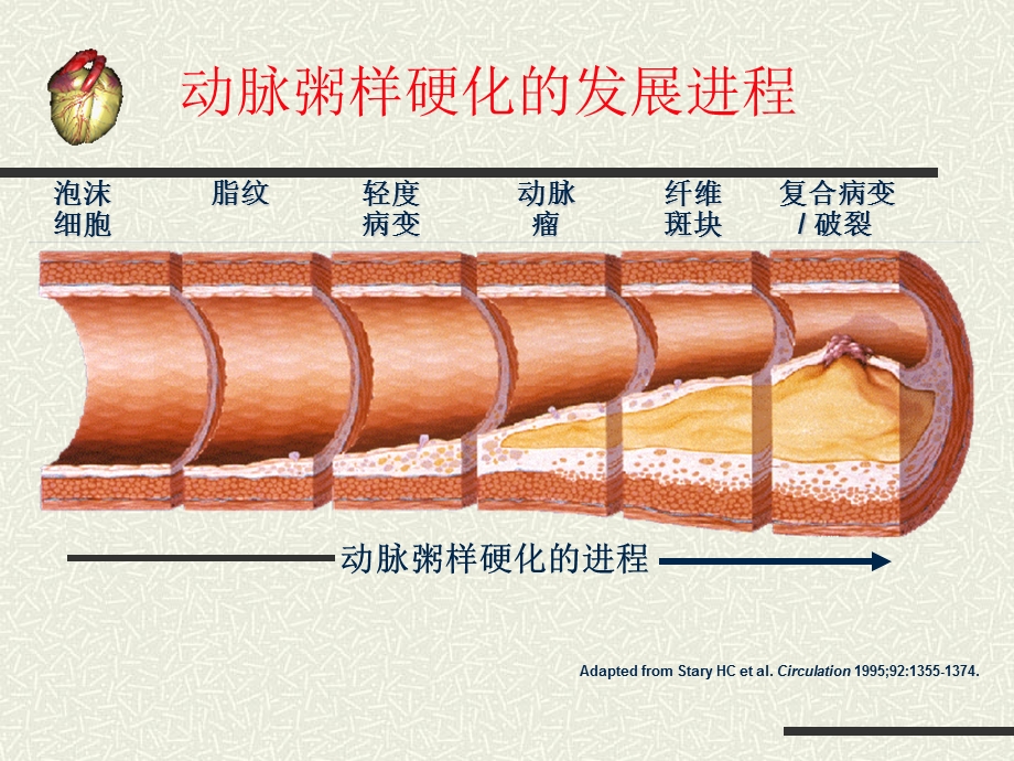 最新：培训资料内3科——急性心肌梗死护理课件文档资料.ppt_第3页