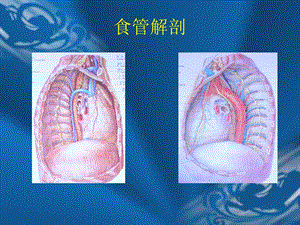 哈尔滨医科大学肿瘤外科食管疾病PPT课件.ppt