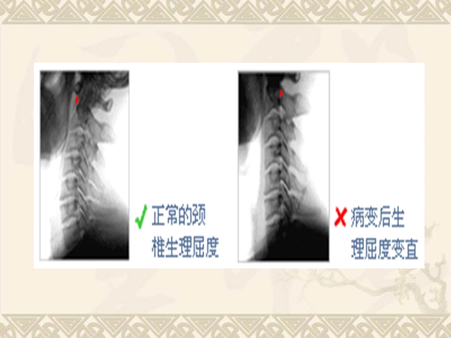 办公室保健、颈椎、腰椎病预防讲座.ppt_第3页