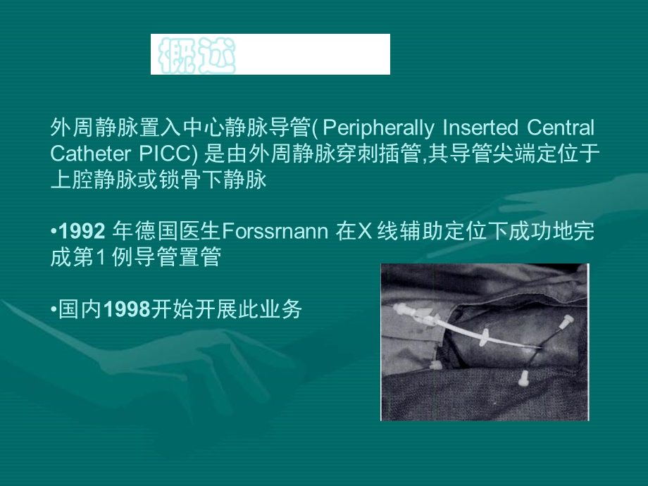 PICC置管术.ppt_第2页