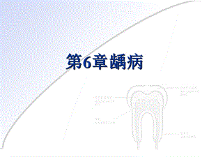 龋病PPT精品医学课件.ppt