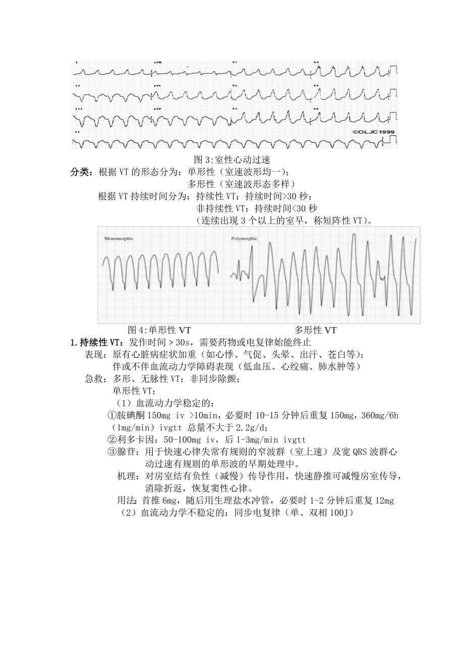 致命性心律失常总结汇总.doc_第2页