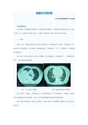 肺内结节鉴别课件资料.doc