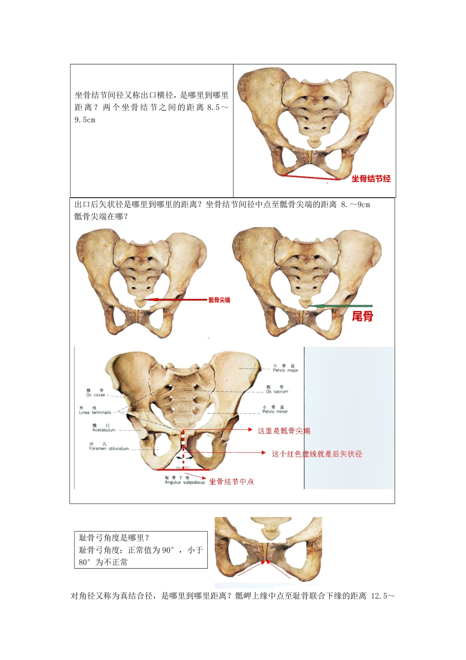 骨盆测量一看就懂.doc_第3页