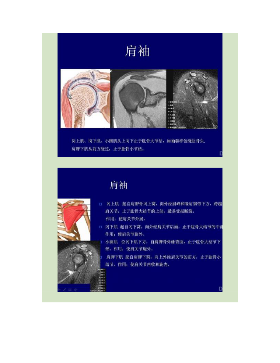 肩关节磁共振影像诊断讲解.doc_第2页