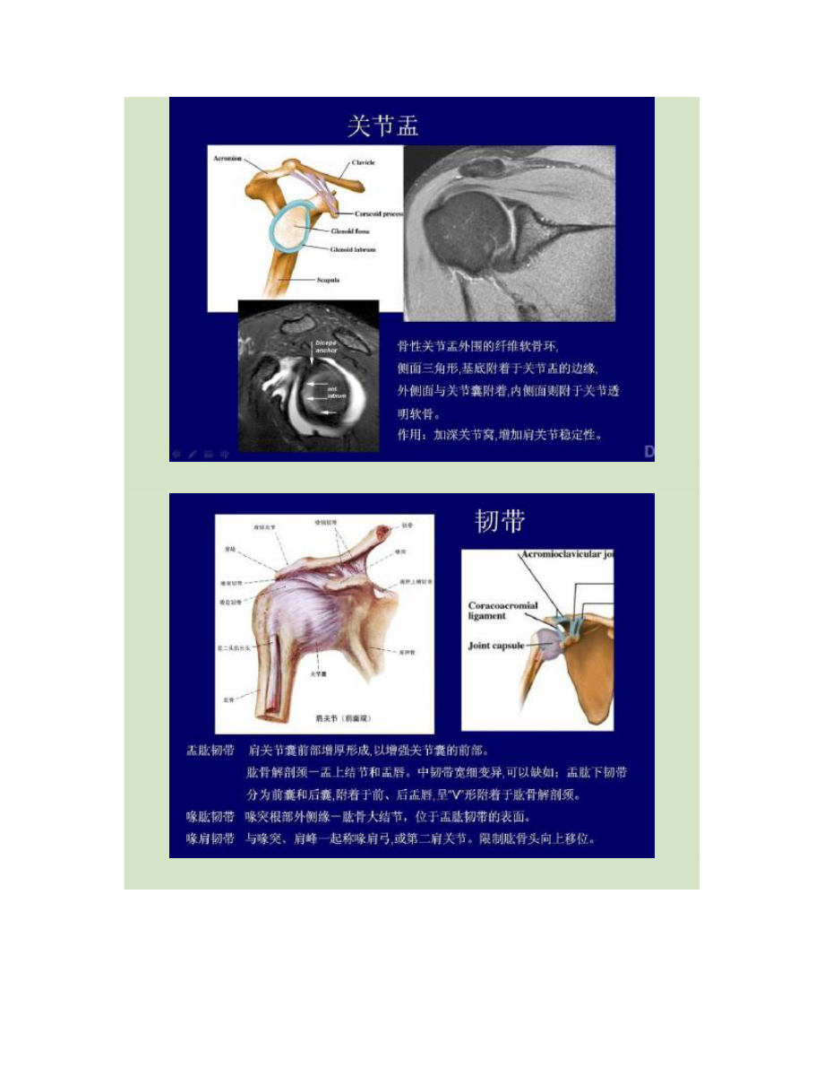 肩关节磁共振影像诊断讲解.doc_第3页