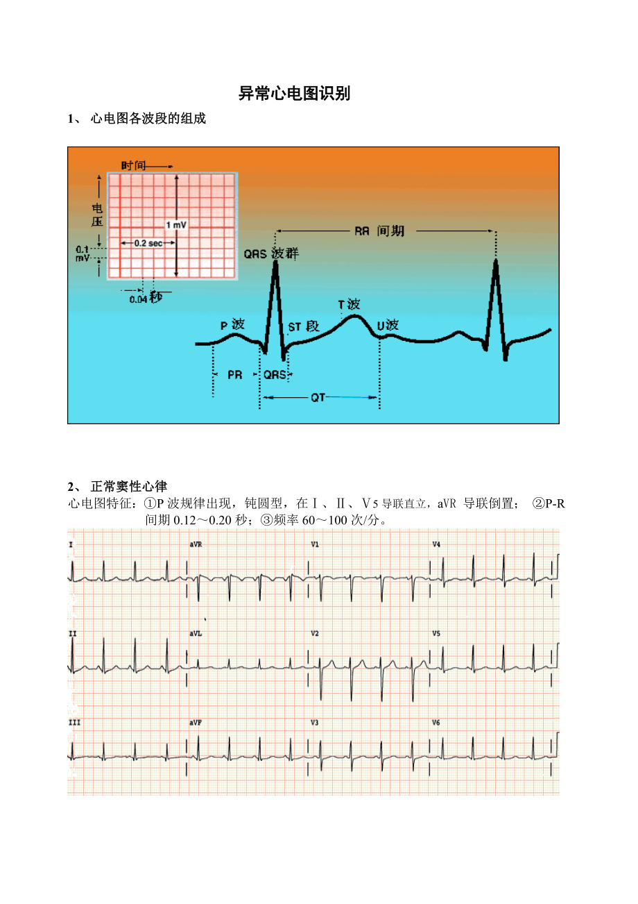 异常心电图识别.doc_第1页