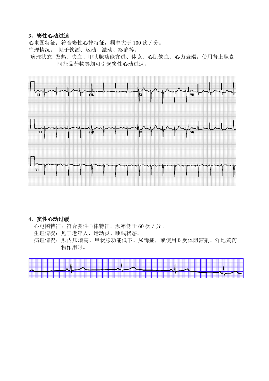 异常心电图识别.doc_第2页