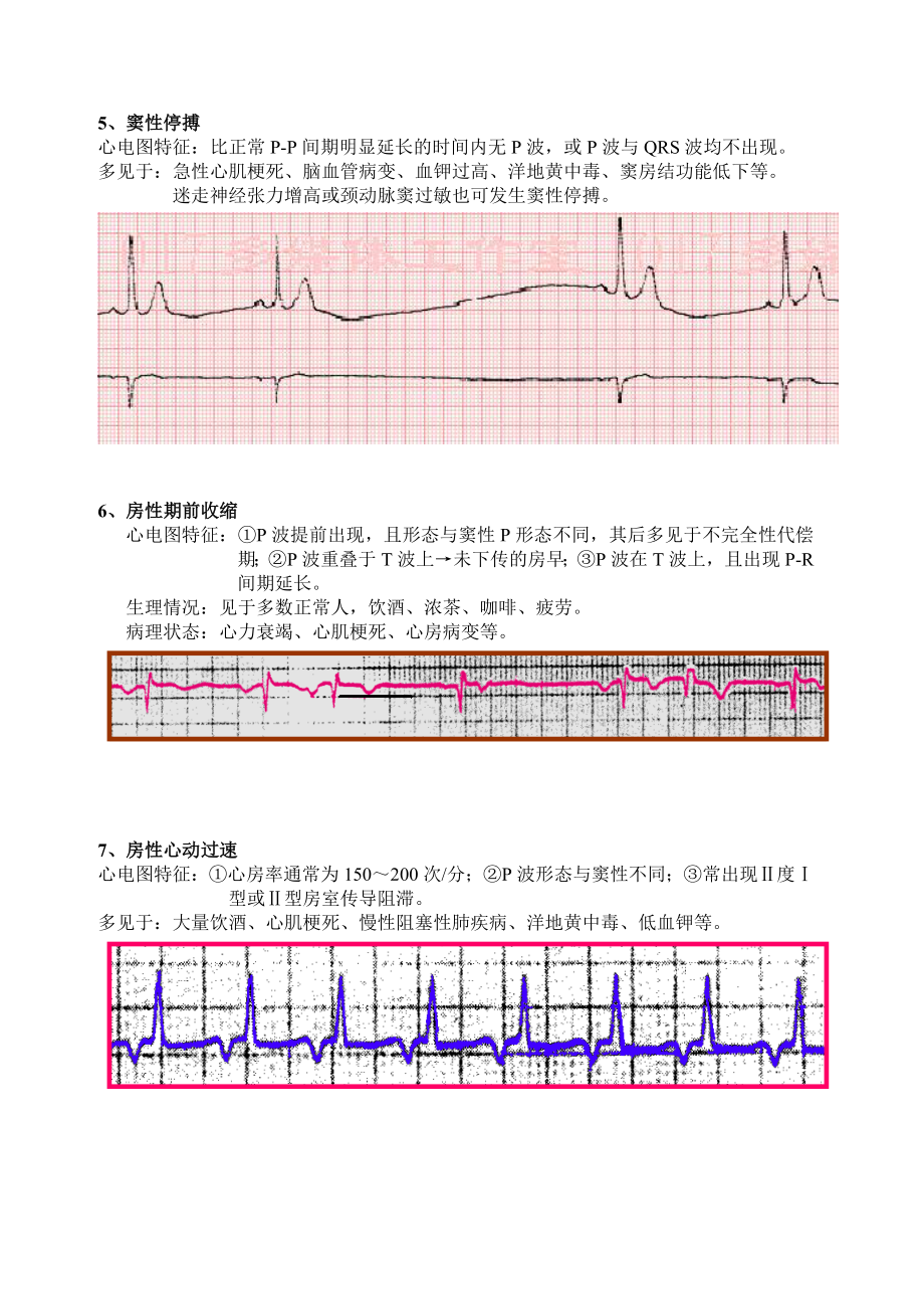 异常心电图识别.doc_第3页