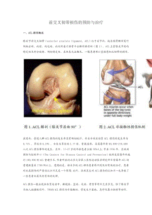 前交叉韧带损伤的预防与治疗概要.doc