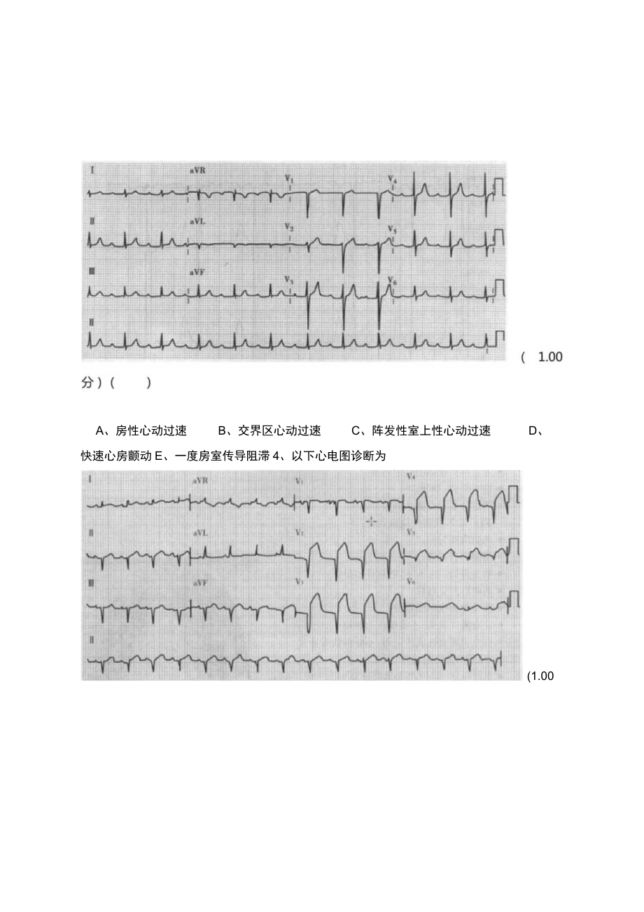 住院医师规范化培训(心电图识别专项练习).docx_第2页