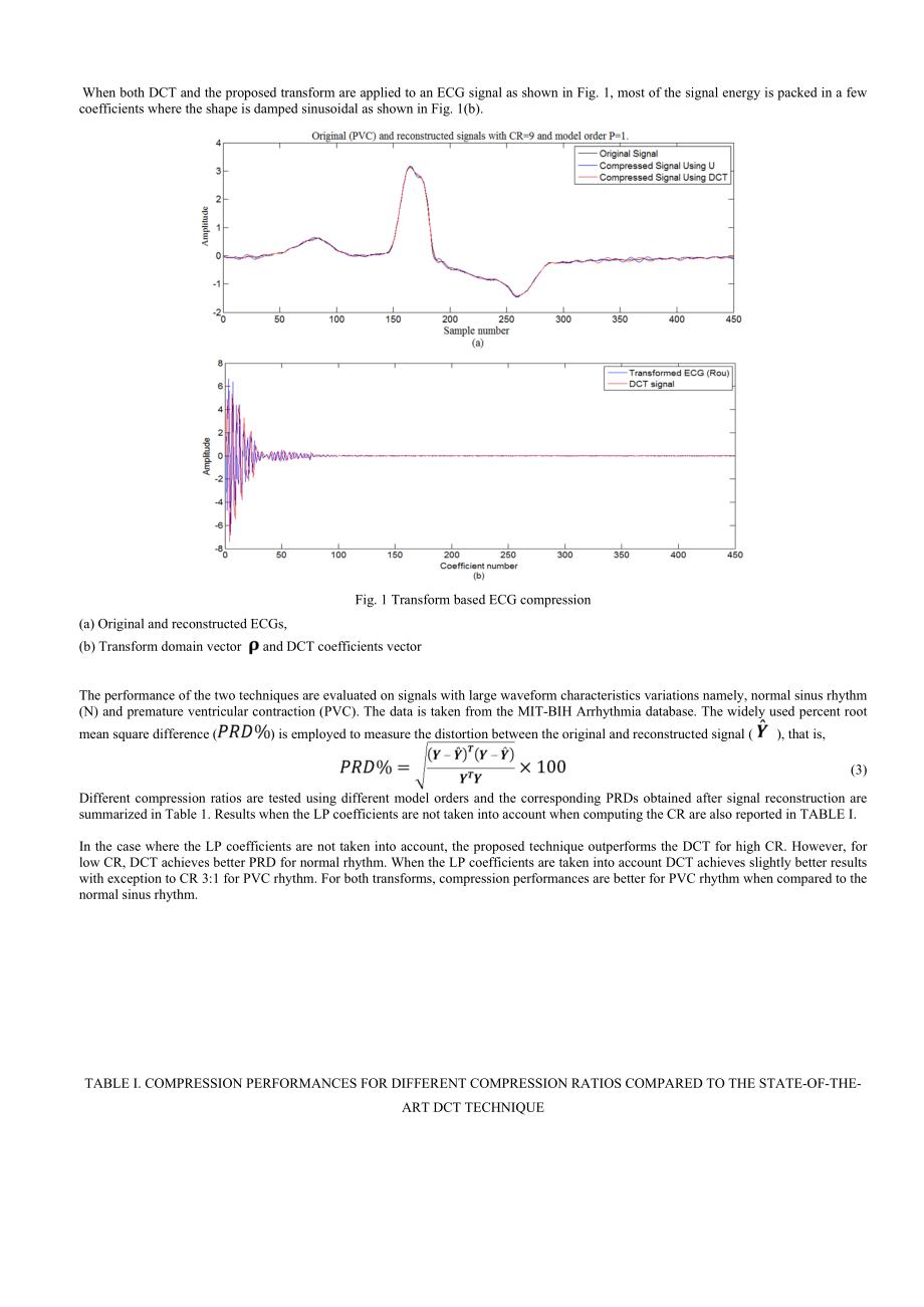 SIGNALDEPENDENT ORTHOGONAL TRANSFORM FOR ECG SIGNAL ANALYSIS.doc_第2页