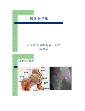 外科学第八版股骨头坏死课件.doc