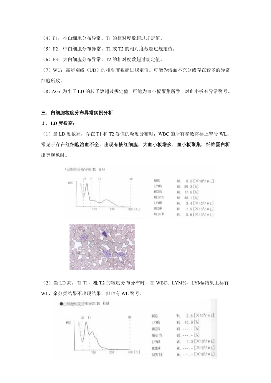 血常规直方图解析.doc_第3页