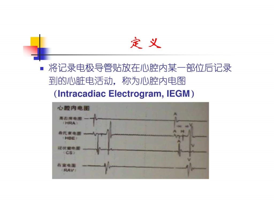 腔内心电图.ppt.ppt_第2页