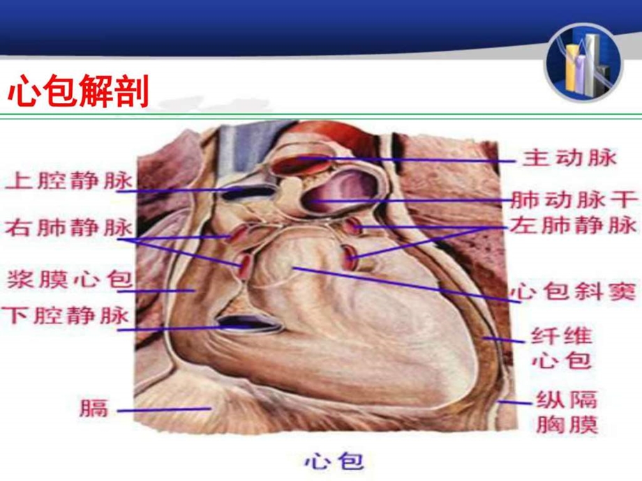 心包积液及心包填塞图文.ppt.ppt_第2页