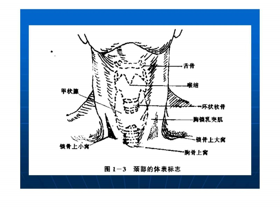 锁骨下静脉穿刺图.ppt.ppt_第3页