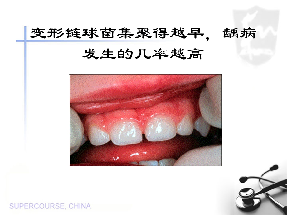 变形链球菌的母子传播.ppt_第3页