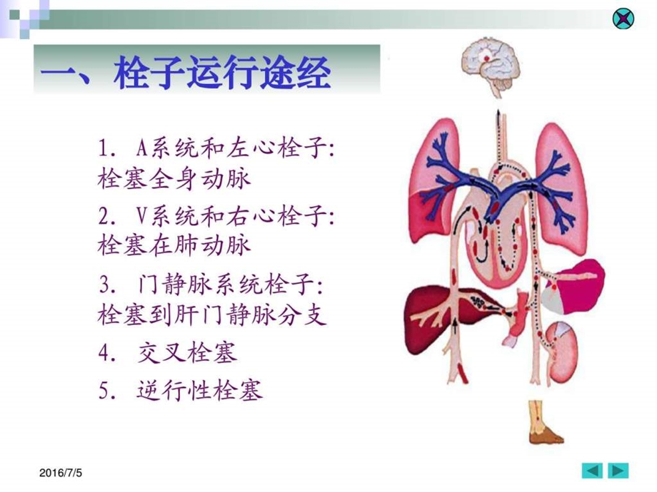 3局部血液循环障碍图文.ppt.ppt_第2页