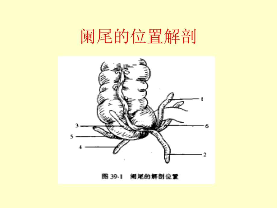 阑尾炎诊断治疗手术课件全.ppt_第3页