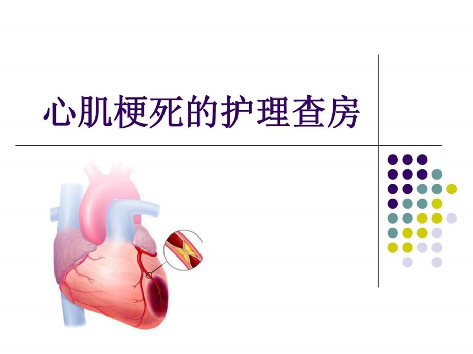 心肌梗死护理查房.ppt_第1页