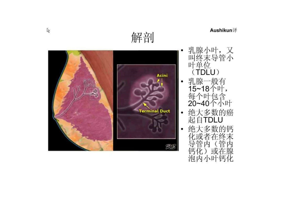 乳腺钙化图文.ppt.ppt_第2页