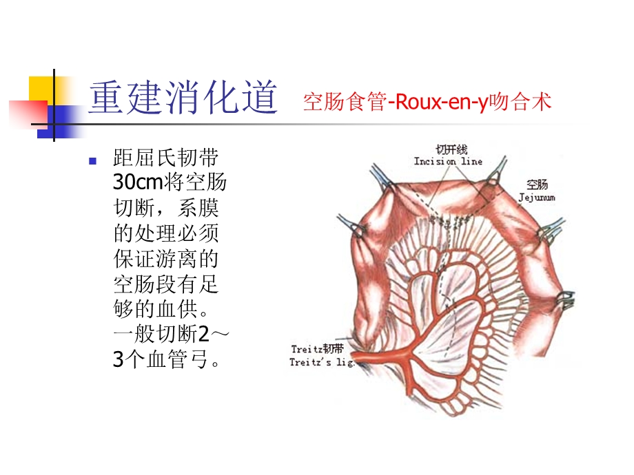 图解全胃切除术二.ppt_第2页