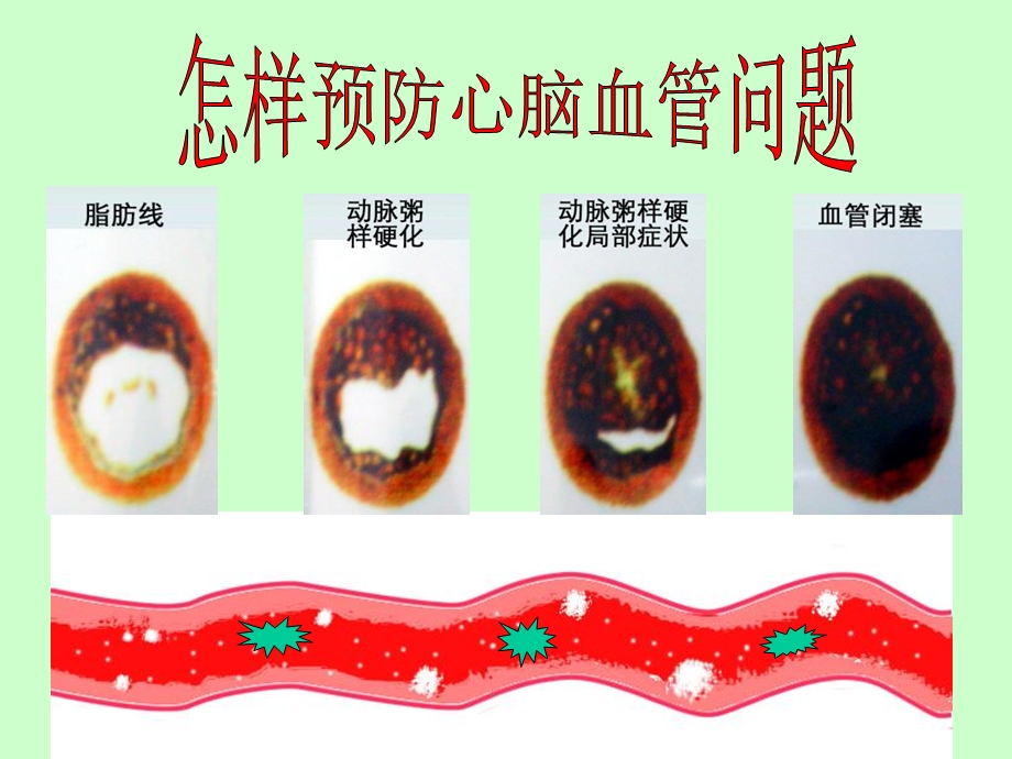 怎样清洗血管.ppt_第1页