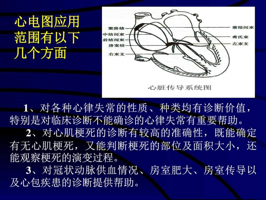 心电图基本知识1668477534.ppt.ppt_第3页