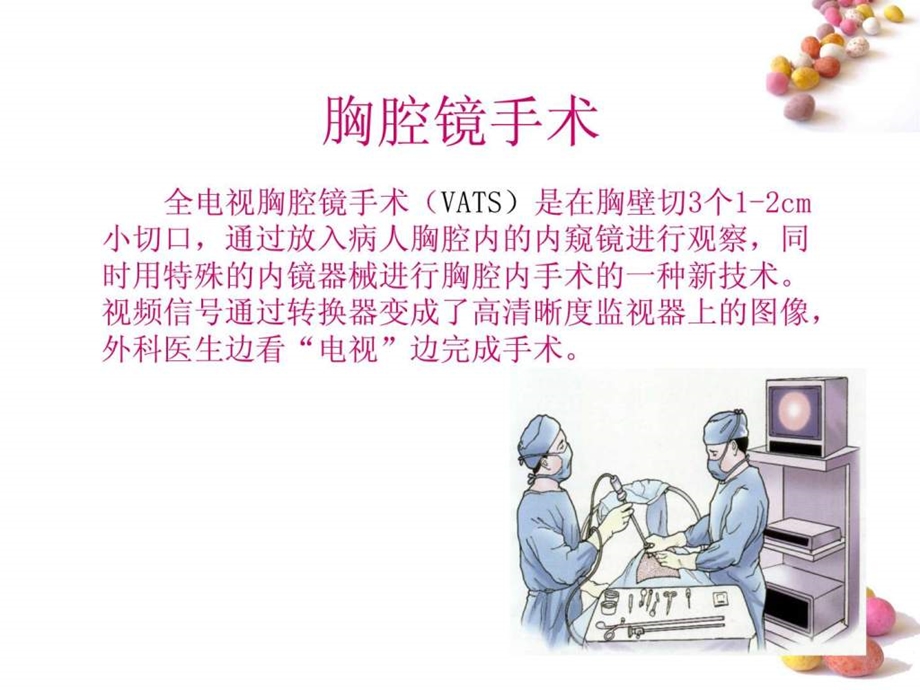 胸腔镜手术术前术后护理.ppt.ppt_第2页