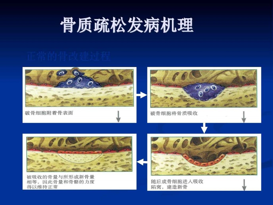 原发性骨质疏松症诊治指南图文.ppt.ppt_第3页