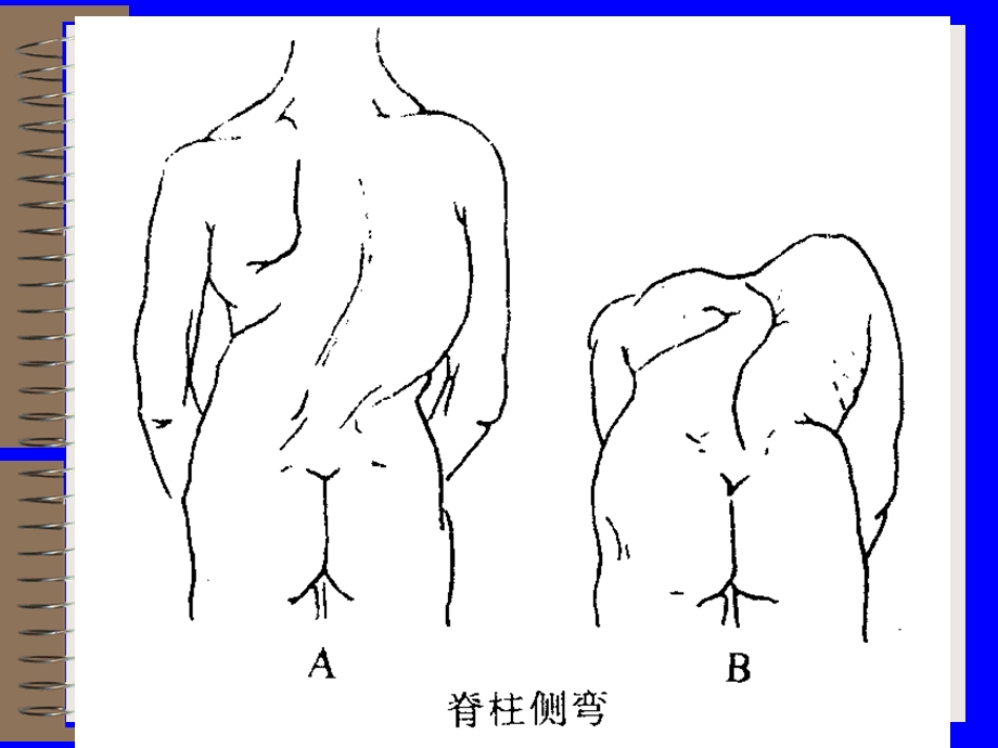 骨科神经系统检查php.ppt_第3页