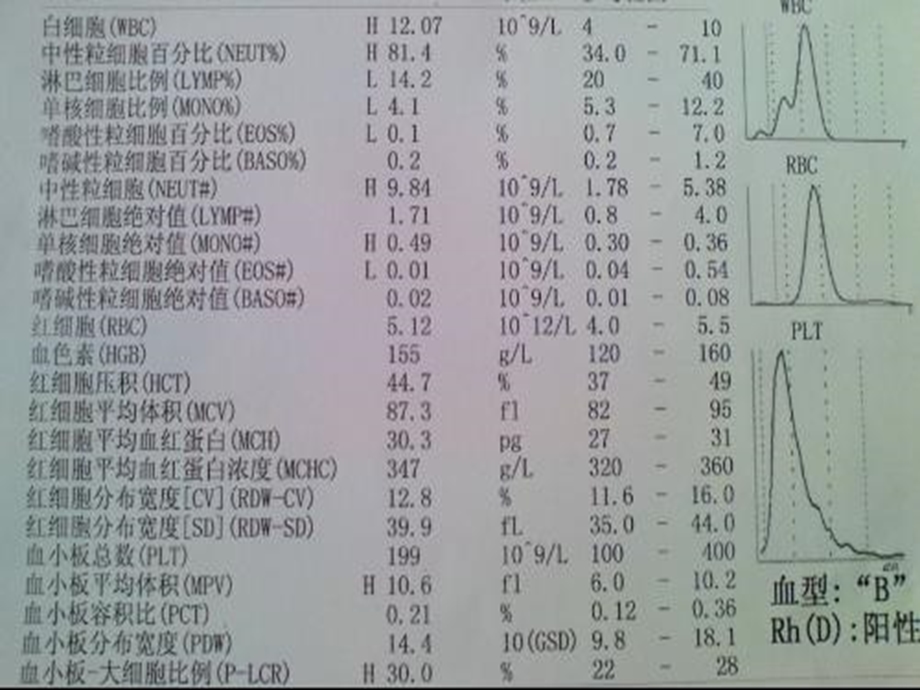 8红细胞和血红蛋白的检验.ppt_第3页