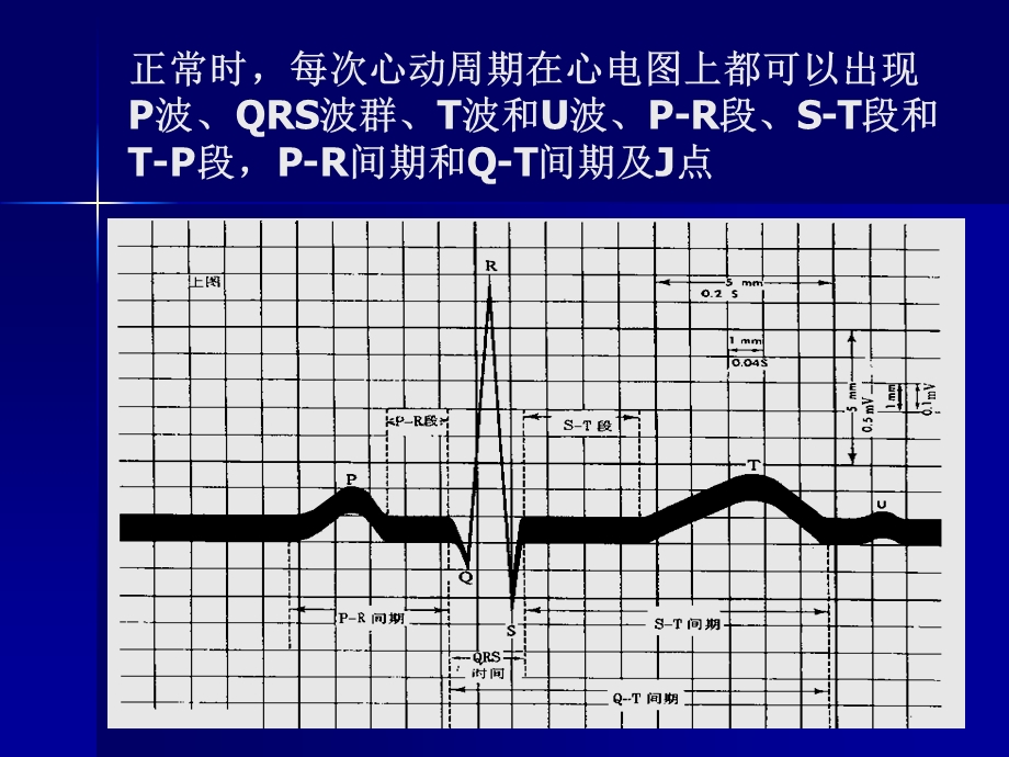 正常心电图学.ppt_第3页