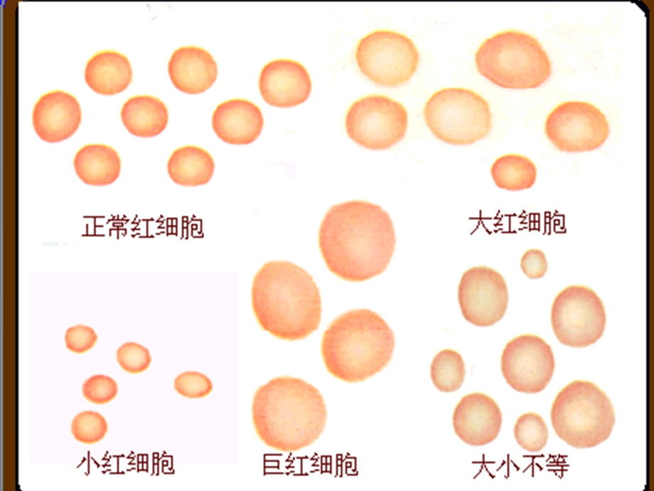 第23章血细胞分析仪的检测技术及临床应用.ppt_第3页