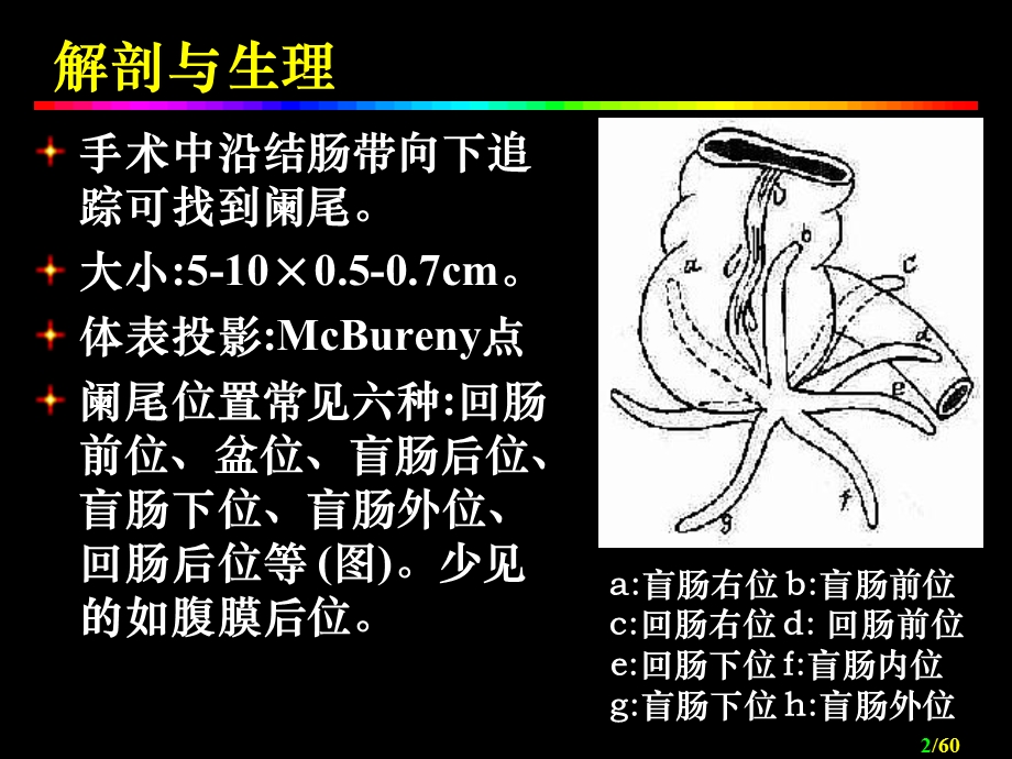 阑尾炎Acuteappendicitis.ppt_第2页