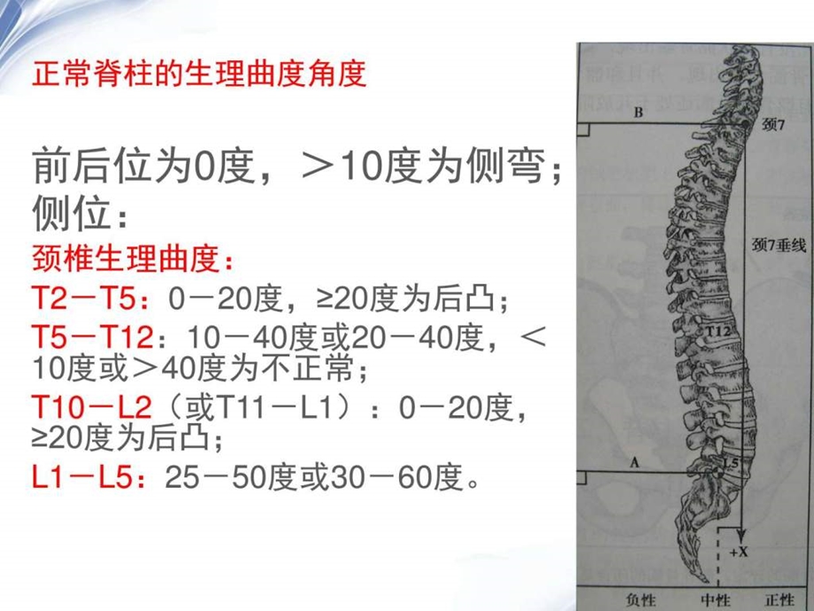 最新脊柱疾病X光片阅片课件图文.ppt.ppt_第3页