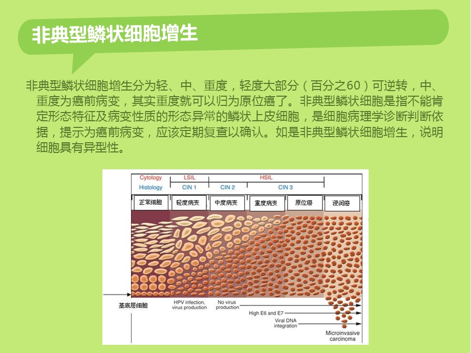 非典型鳞状细胞是什么意思.ppt_第3页