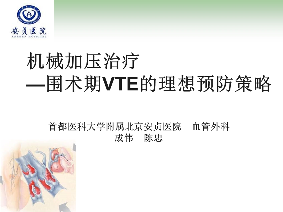 机械加压治疗围术期VTE的理想预防策略.ppt