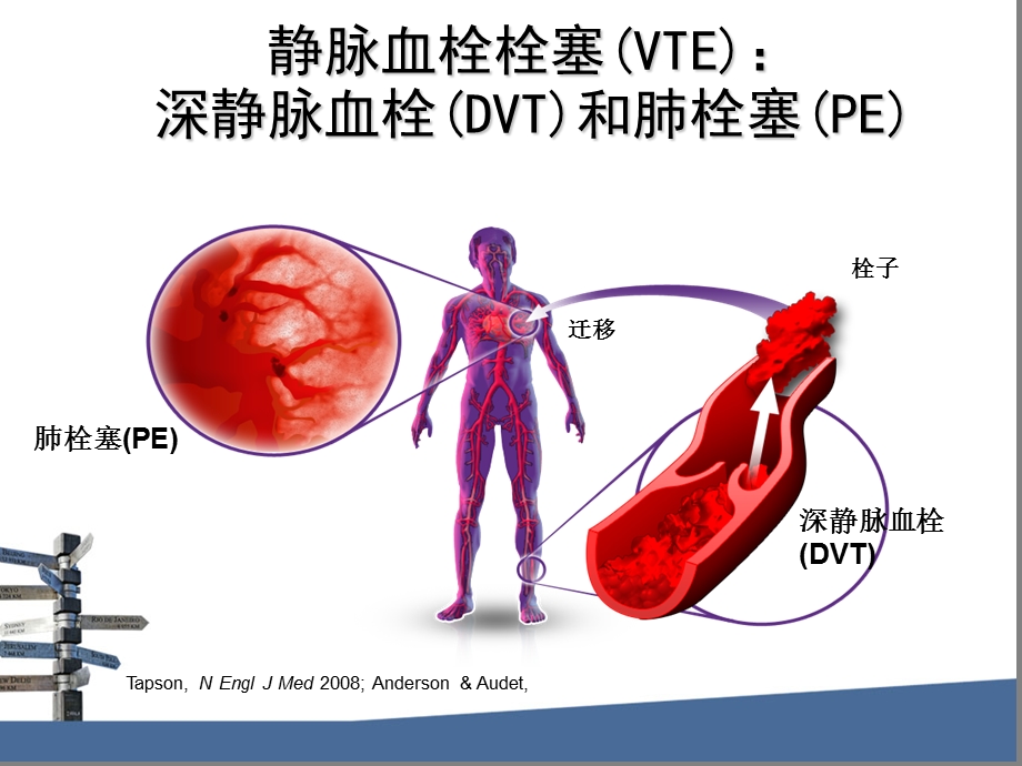 一例VTE患者的药学服务.ppt_第2页