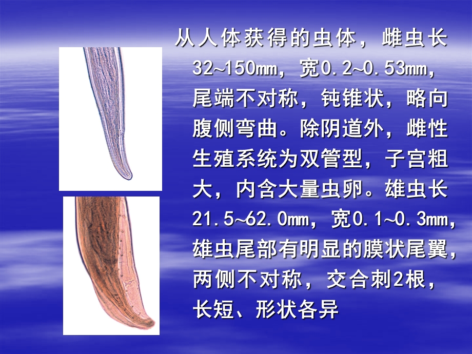 第二节美丽筒线虫.ppt_第3页